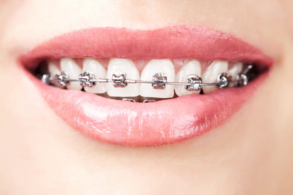How has orthodontics changed in the last 20 years?