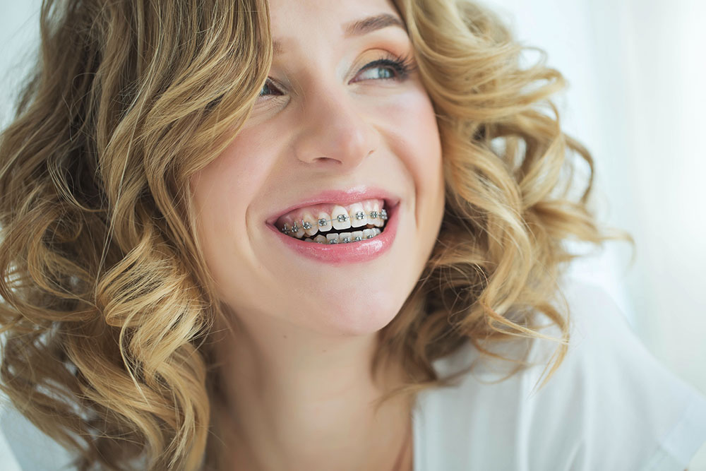 braces never too adult re orthodontics