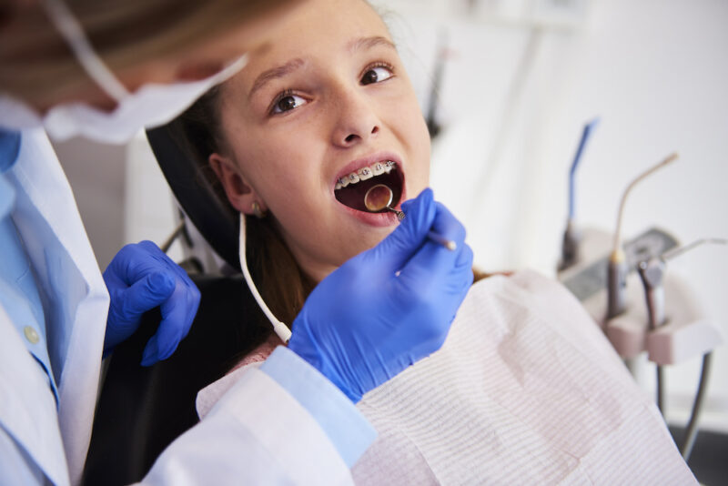 What Are Teeth Spacers? Orthodontist in Fort Collins