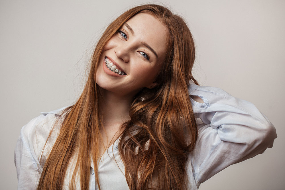 What are Ceramic Braces?  Lutherville, MD Orthodontist